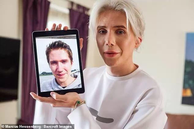 Crazy! Man Spent 1 Million RMB to Look Like An Asian! Crazy! Man Spent 1 Million RMB to Look Like An Asian!