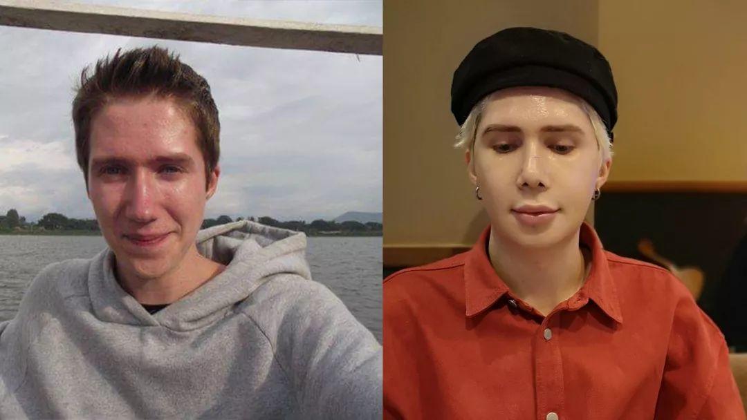 Crazy! Man Spent 1 Million RMB to Look Like An Asian! Crazy! Man Spent 1 Million RMB to Look Like An Asian!