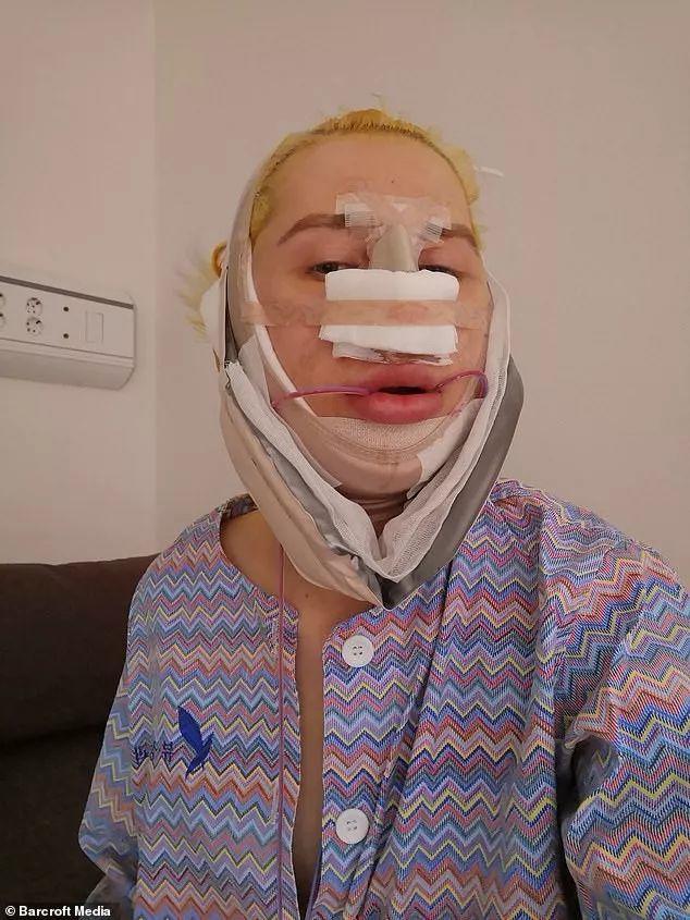 Crazy! Man Spent 1 Million RMB to Look Like An Asian! Crazy! Man Spent 1 Million RMB to Look Like An Asian!