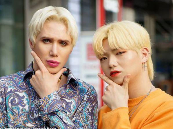 Crazy! Man Spent 1 Million RMB to Look Like An Asian! Crazy! Man Spent 1 Million RMB to Look Like An Asian!